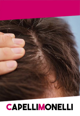 Anticaduta_2_258x375