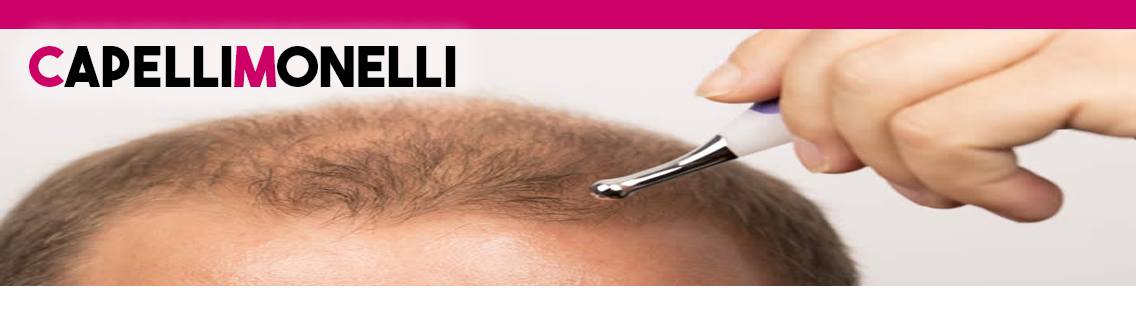 FIALE ANTICADUTA FIALE ANTICADUTA